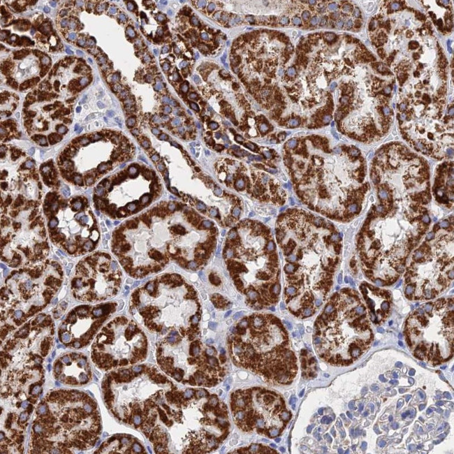 IFT80 Antibody in Immunohistochemistry (Paraffin) (IHC (P))