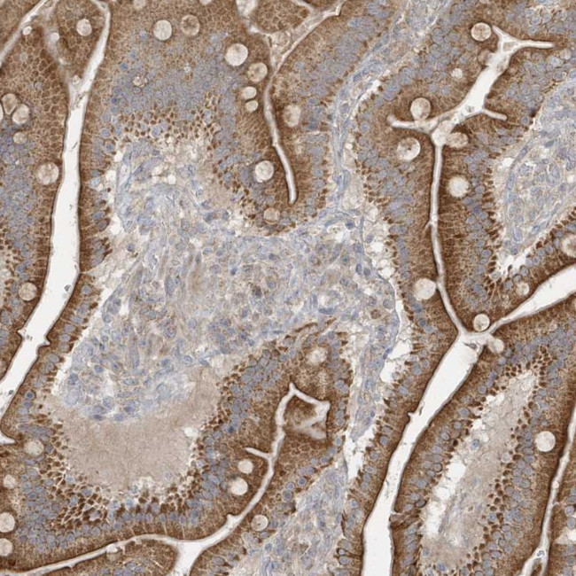 THG1L Antibody in Immunohistochemistry (Paraffin) (IHC (P))