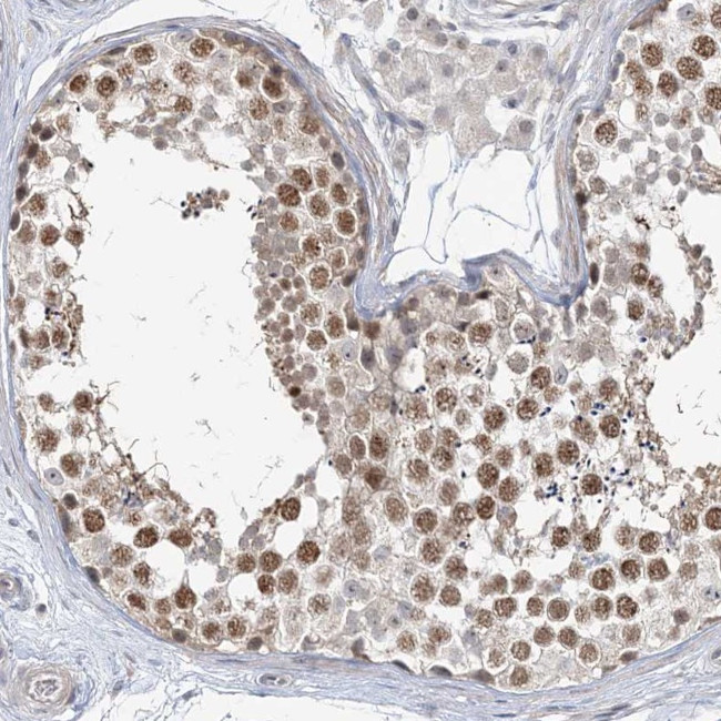 C1orf177 Antibody in Immunohistochemistry (Paraffin) (IHC (P))