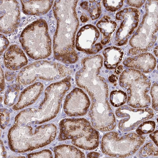 FAM196A Antibody in Immunohistochemistry (Paraffin) (IHC (P))