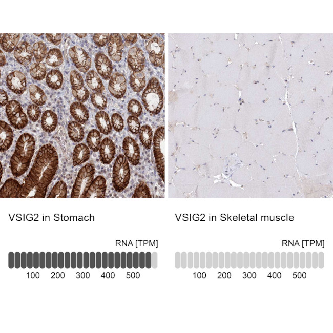 VSIG2 Antibody