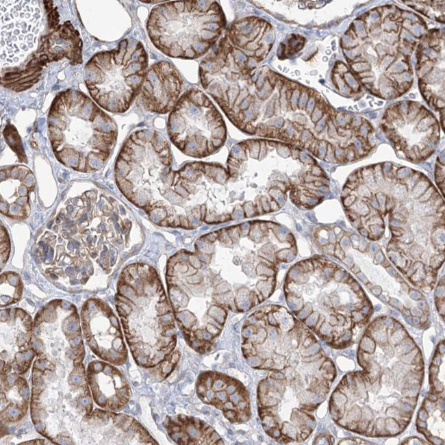 PEPP2 Antibody in Immunohistochemistry (Paraffin) (IHC (P))
