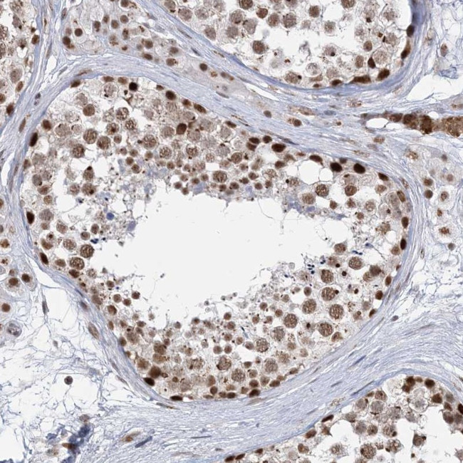 PLRG1 Antibody in Immunohistochemistry (Paraffin) (IHC (P))