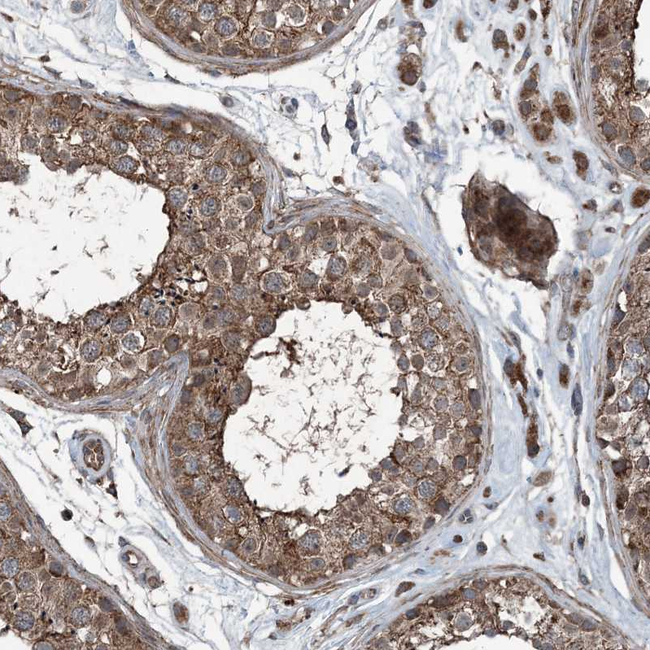 NDUFA2 Antibody in Immunohistochemistry (Paraffin) (IHC (P))