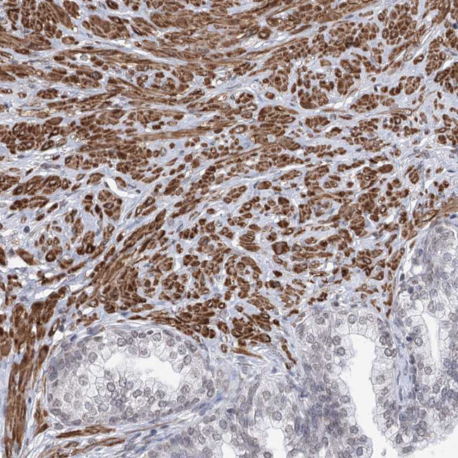 RBM27 Antibody in Immunohistochemistry (Paraffin) (IHC (P))