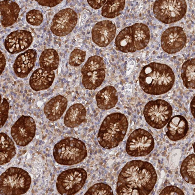 PAIP2 Antibody in Immunohistochemistry (Paraffin) (IHC (P))