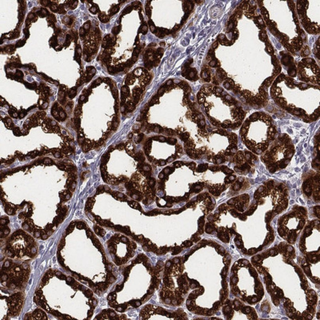 CSN3 (CASK) Antibody in Immunohistochemistry (IHC)