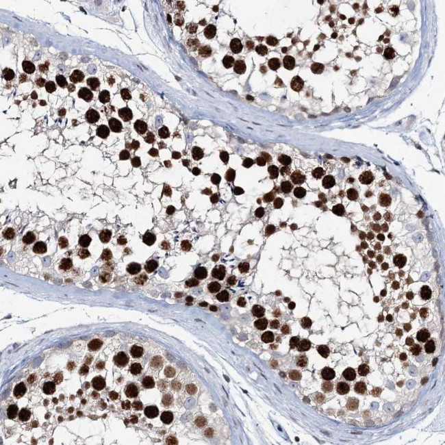 LRRFIP2 Antibody in Immunohistochemistry (Paraffin) (IHC (P))