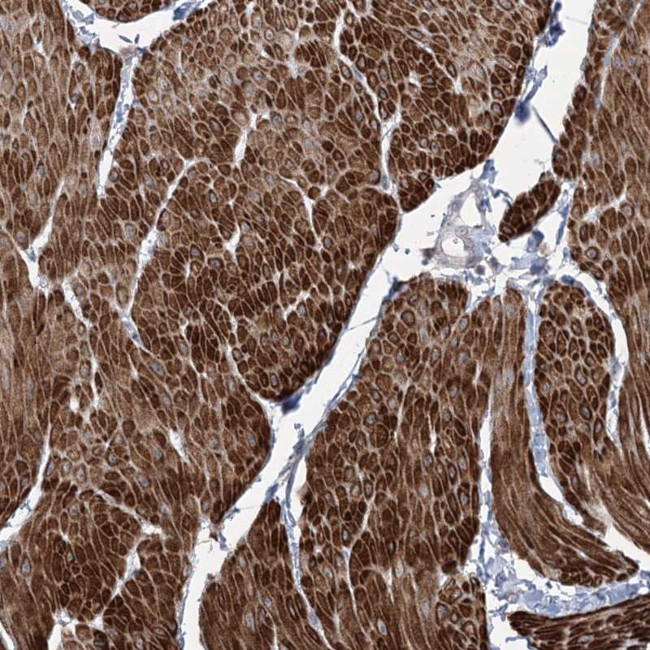 ZSCAN23 Antibody in Immunohistochemistry (Paraffin) (IHC (P))