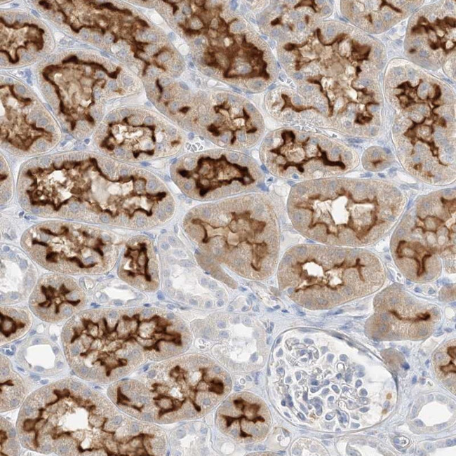 SLC22A13 Antibody in Immunohistochemistry (Paraffin) (IHC (P))