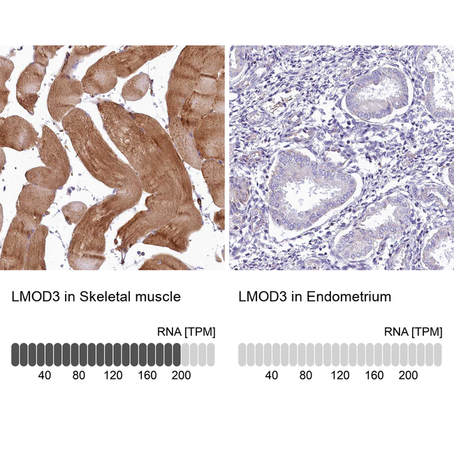 LMOD3 Antibody in Immunohistochemistry (Paraffin) (IHC (P))