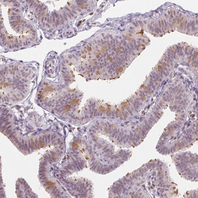 LRRC48 Antibody in Immunohistochemistry (Paraffin) (IHC (P))