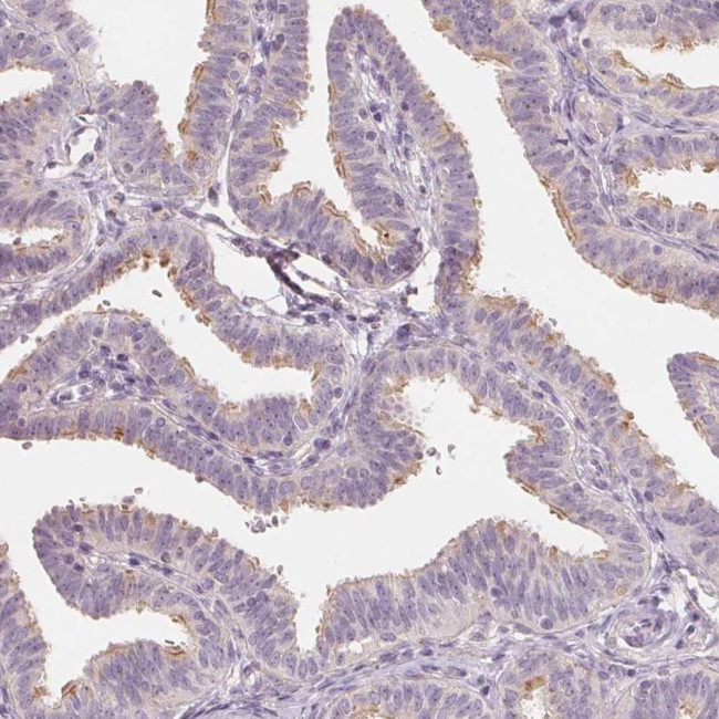 LRRC48 Antibody in Immunohistochemistry (Paraffin) (IHC (P))