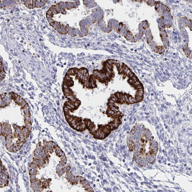 VWDE Antibody in Immunohistochemistry (Paraffin) (IHC (P))