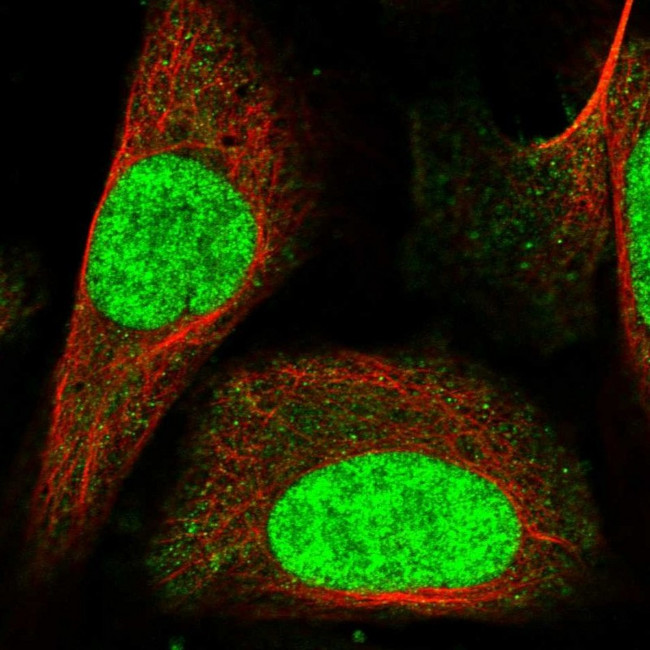 CA052 Antibody in Immunocytochemistry (ICC/IF)