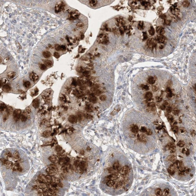 PRSS36 Antibody in Immunohistochemistry (Paraffin) (IHC (P))