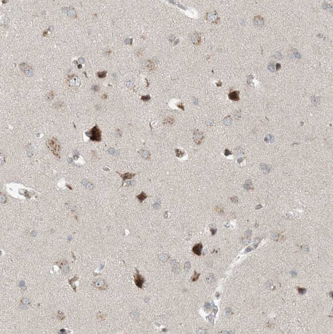 SLC35A2 Antibody in Immunohistochemistry (Paraffin) (IHC (P))