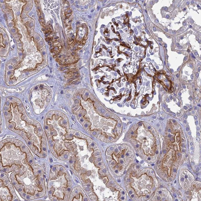 Tensin 1 Antibody in Immunohistochemistry (Paraffin) (IHC (P))