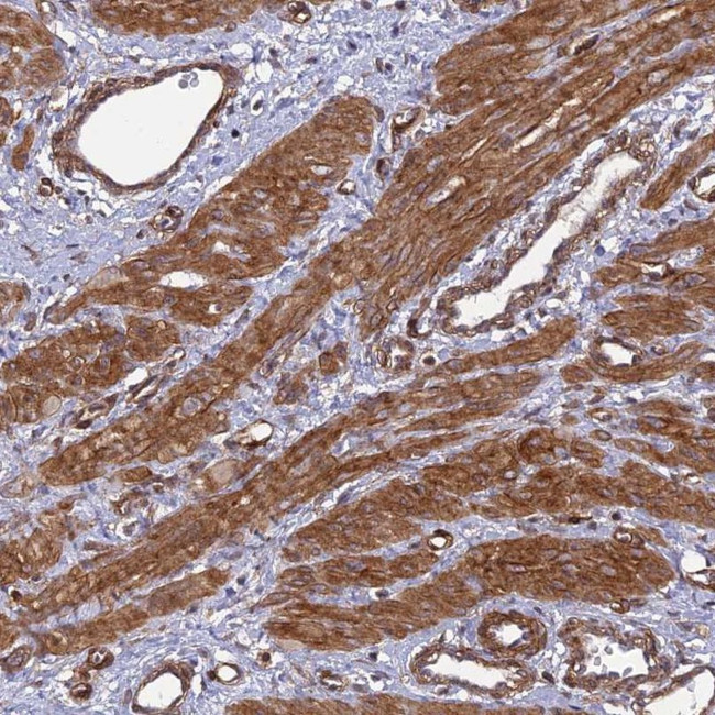 Tensin 1 Antibody in Immunohistochemistry (IHC)