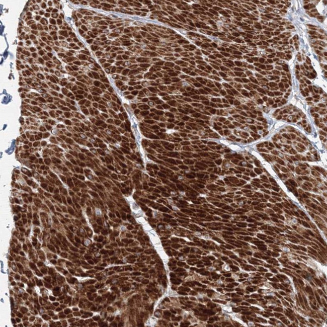 FAM155B Antibody in Immunohistochemistry (Paraffin) (IHC (P))