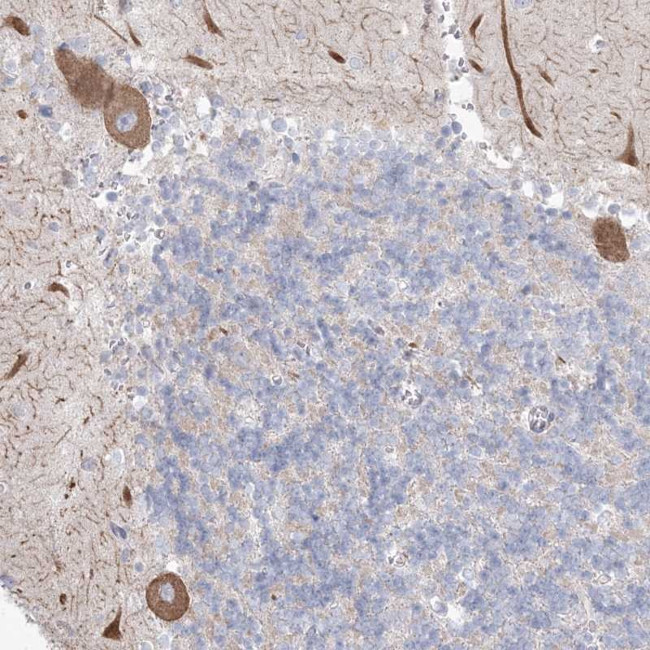 KCTD6 Antibody in Immunohistochemistry (Paraffin) (IHC (P))