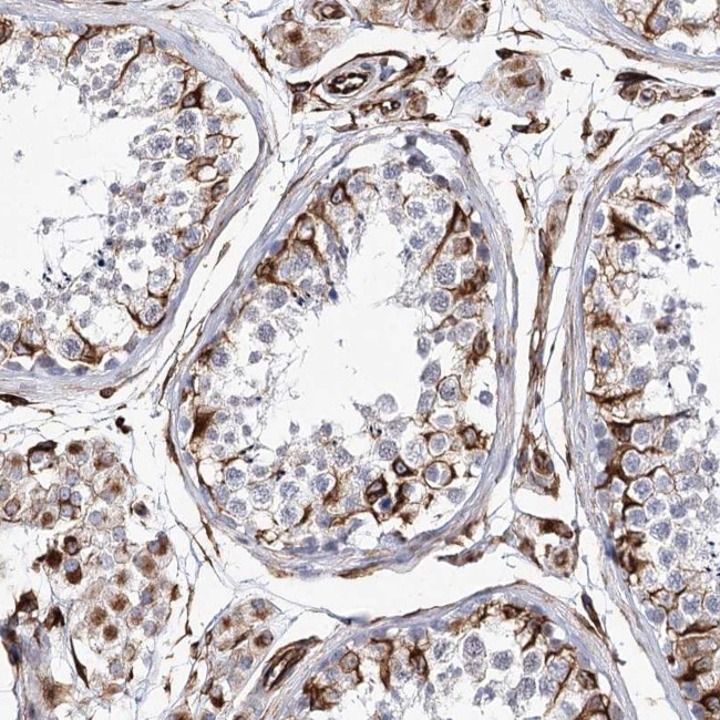ALG1L Antibody in Immunohistochemistry (Paraffin) (IHC (P))