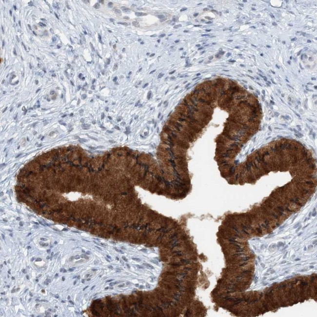 ASCL4 Antibody in Immunohistochemistry (Paraffin) (IHC (P))
