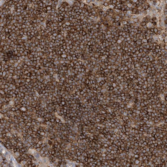 IL1RAPL2 Antibody in Immunohistochemistry (Paraffin) (IHC (P))