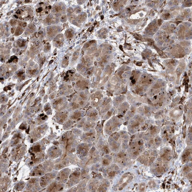 IL1RAPL2 Antibody in Immunohistochemistry (Paraffin) (IHC (P))