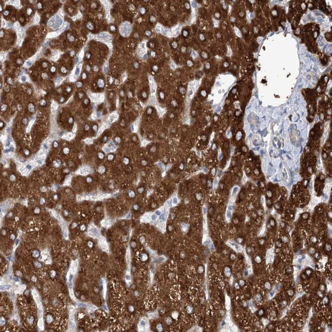 CIB4 Antibody in Immunohistochemistry (Paraffin) (IHC (P))