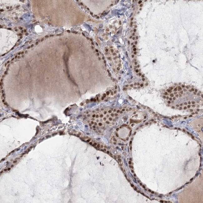 CIB4 Antibody in Immunohistochemistry (Paraffin) (IHC (P))