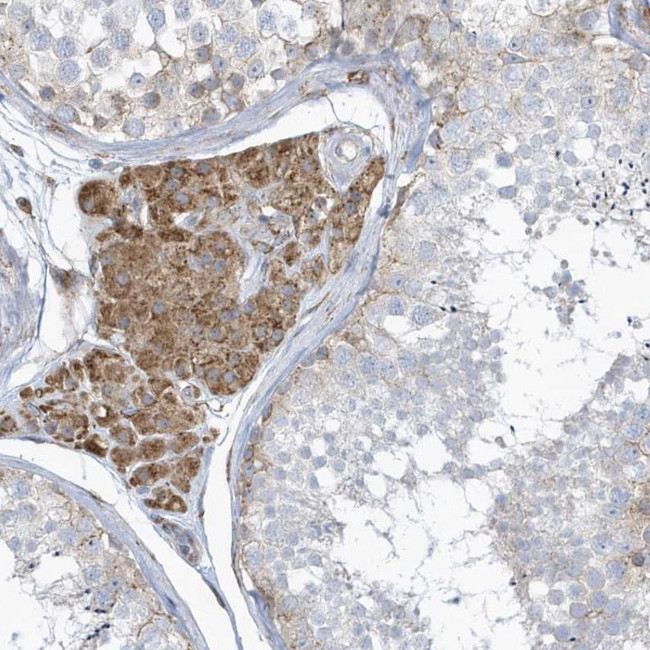 VPRBP Antibody in Immunohistochemistry (Paraffin) (IHC (P))