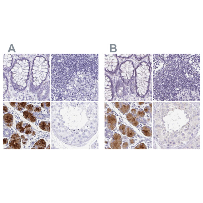 PRR27 Antibody in Immunohistochemistry (IHC)