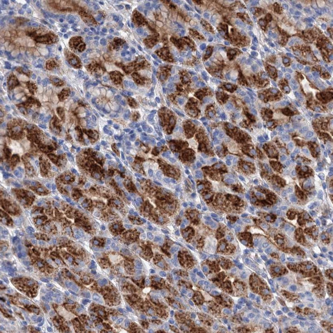 GPR155 Antibody in Immunohistochemistry (Paraffin) (IHC (P))