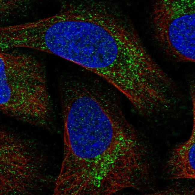 MITD1 Antibody in Immunocytochemistry (ICC/IF)