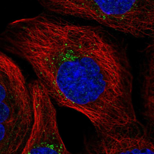 MITD1 Antibody in Immunocytochemistry (ICC/IF)