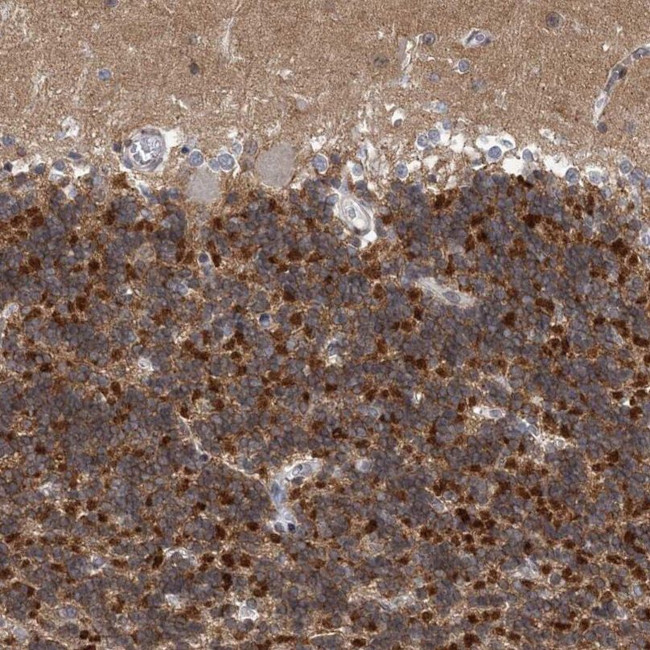 FAM126B Antibody in Immunohistochemistry (IHC)