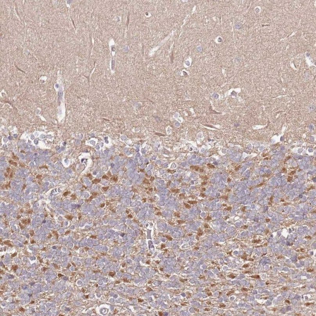 FAM126B Antibody in Immunohistochemistry (IHC)