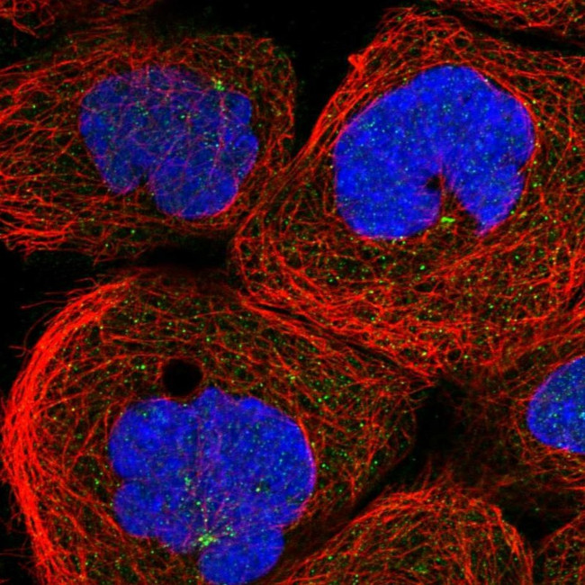 ANKAR Antibody in Immunocytochemistry (ICC/IF)