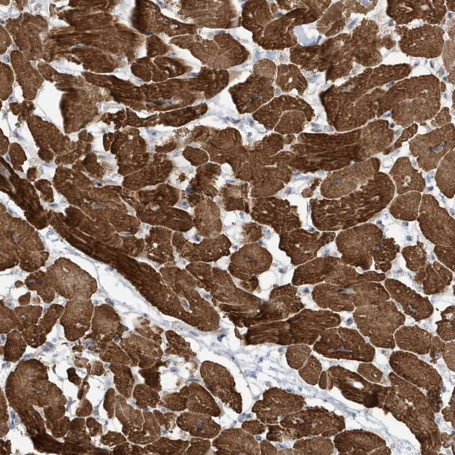 ZNF654 Antibody in Immunohistochemistry (Paraffin) (IHC (P))