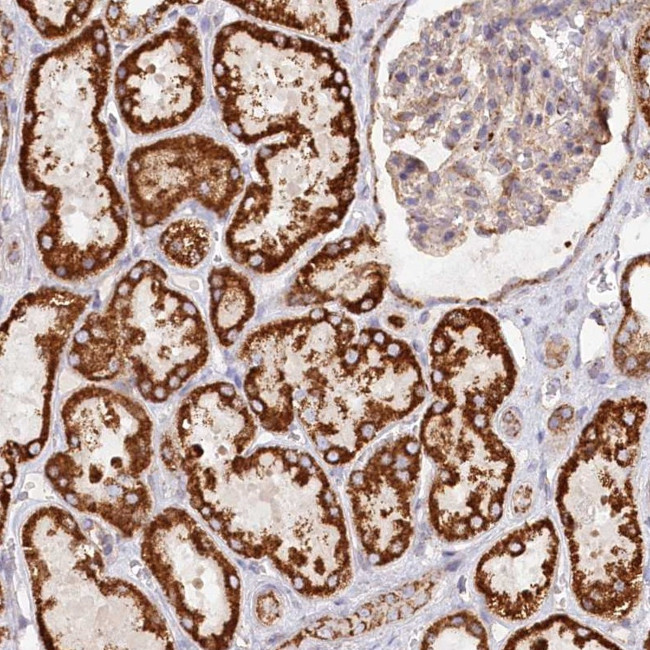UMPS Antibody in Immunohistochemistry (Paraffin) (IHC (P))