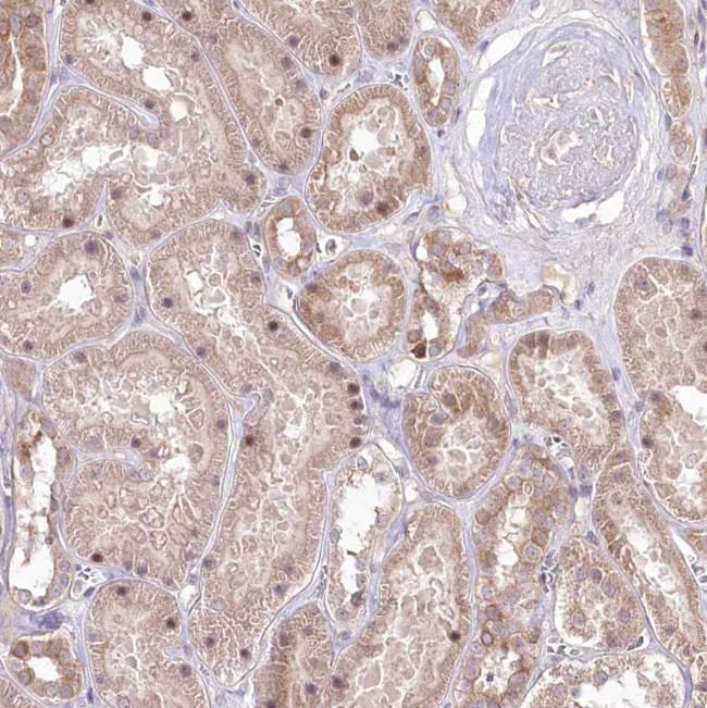 HELT Antibody in Immunohistochemistry (Paraffin) (IHC (P))