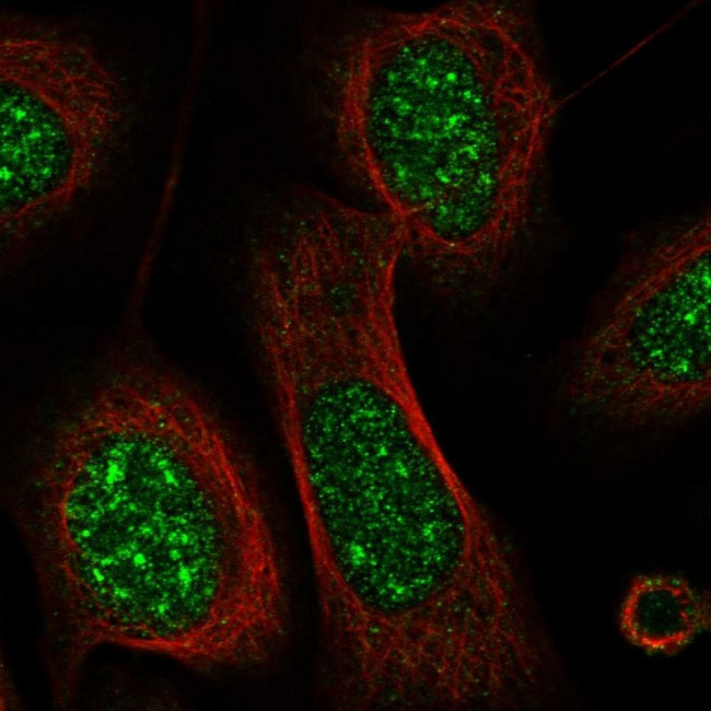 CRIP3 Antibody in Immunocytochemistry (ICC/IF)