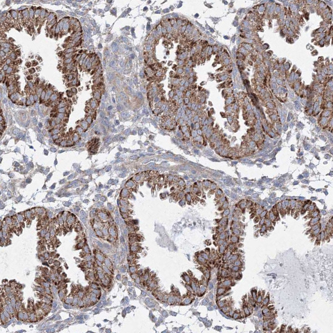 WDR49 Antibody in Immunohistochemistry (Paraffin) (IHC (P))