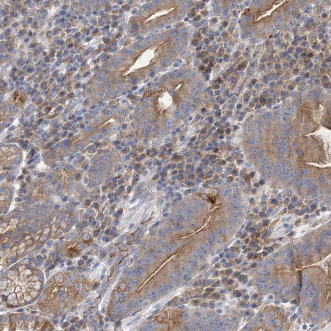 ATP11B Antibody in Immunohistochemistry (Paraffin) (IHC (P))