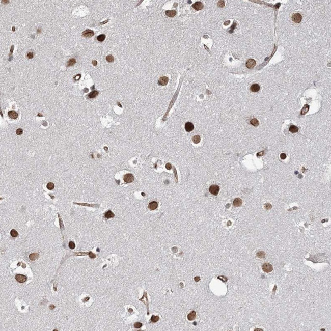ATP11B Antibody in Immunohistochemistry (Paraffin) (IHC (P))