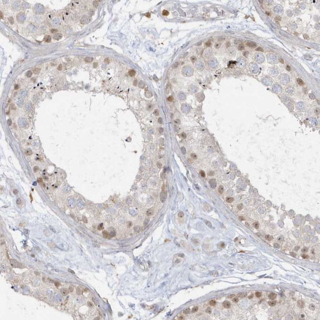 NAF1 Antibody in Immunohistochemistry (Paraffin) (IHC (P))