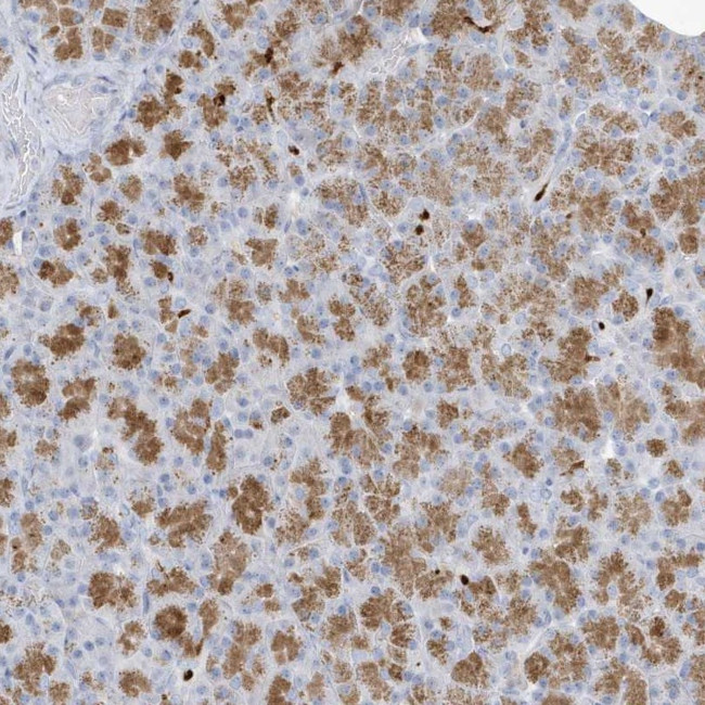 FAM98A Antibody in Immunohistochemistry (Paraffin) (IHC (P))