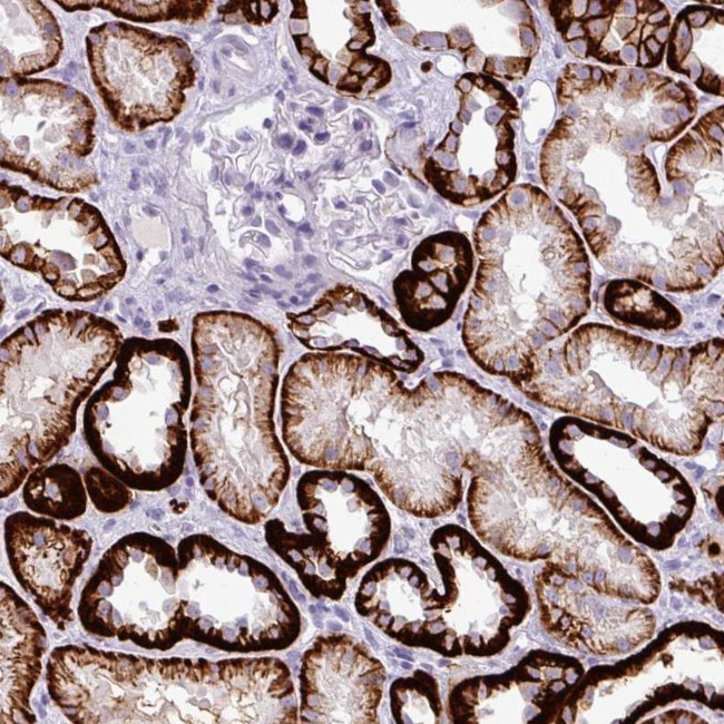 CDH16 Antibody in Immunohistochemistry (Paraffin) (IHC (P))