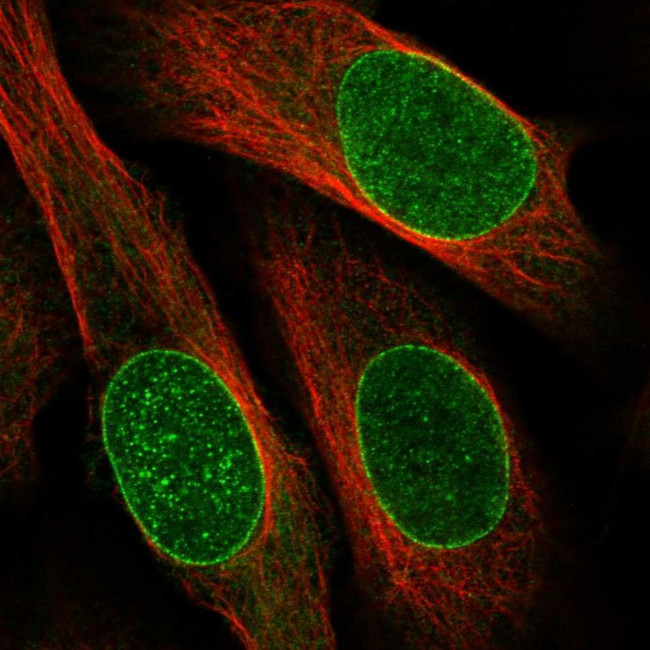 DNAJB2 Antibody in Immunocytochemistry (ICC/IF)